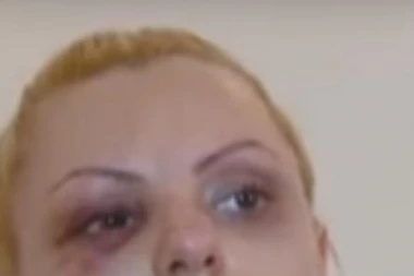 MENADŽER PRETUKAO PEVAČICU, pa objavio da je imala NESREĆU!