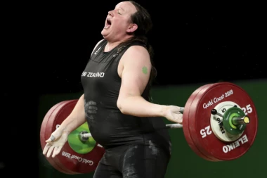 (FOTO) Bolje joj išlo dok je bila muško, JEZIVA POVREDA DIZAČICE TEGOVA