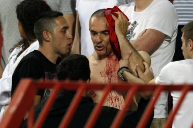 (VIDEO) 11 osoba povređeno na derbiju, pet primljeno u Urgentni