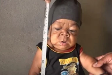 (FOTO) ČUDO! Čovek (23) zarobljen u telu BEBE: Meštani misle da je inkarnacija Boga