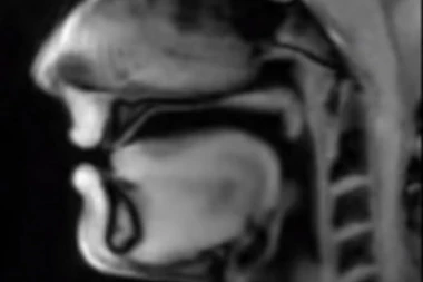 OVAKO IZGLEDA SRCE: SNIMAK KOJI ĆE VAS OSTAVITI BEZ DAHA!