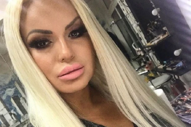 (FOTO) DŽIDŽA STOJKOVIĆ POTPUNO PROMENILA IZGLED: Povukla se sa scene i uradila operaciju na licu o kojoj se danima priča!