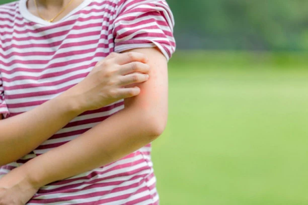 Ako ste ALERGIČNI na polen NE JEDITE ovih 5 namirnica jer izazivaju ANAFALAKTIČKI ŠOK