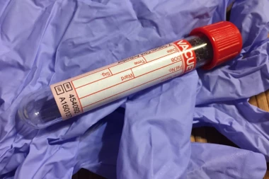 REVOLUCIONARNO OTKRIĆE KOREANACA: Pronašli test koji istovremeno otkriva OVE DVE GADNE BOLESTI