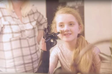 "HERO ARM": Bionička ruka za decu - da se najmlađi osećaju kao SUPERHEROJI!