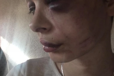 MONSTRUM IZ BUJANOVCA U BEKSTVU: Pretukao trudnu drugaricu jer nije htela se*s sa njim