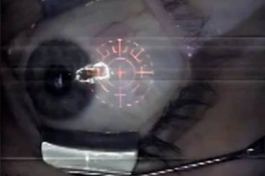 (FOTO) DA LI BISTE PLATILI 3.000 DOLARA ZA PIRSING U OKU?!