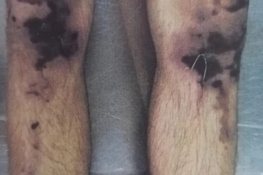 (STRAVIČAN SADRŽAJ) Pojavile se nove fotografije i JEZIVI DOKAZI sa obdukcije Davida Dragičevića (21)