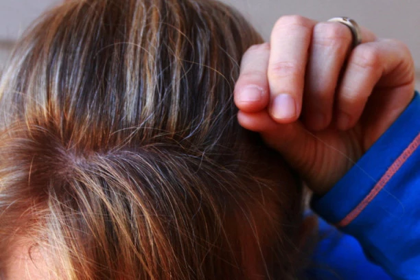 PRIRODNO REŠENJE PROTIV SEDE KOSE: Uz ovaj trik recite zbogom belim vlasima!