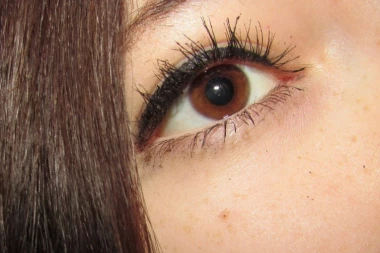 (VIDEO) Zgrozićete se! Devojku su bolele oči, pa je otišla kod doktora, on nije mogao da veruje šta vidi!