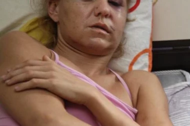 (UZNEMIRUJUĆ SADRŽAJ) IZA REŠETAKA: Bokser vezao, pa udarao po glavi devojku iz sve snage dok joj nije izbio sve zube!