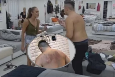 OVO SU SLOBINE RANE koje mu je nanela Luna!