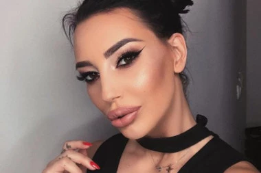 Još sam pod terapijom: Katarina Grujić jedva izbegla operaciju bubrega, evo kako se sada oseća!