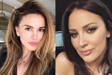 HIRURG PROGOVORIO: Severinina USTA SU LOŠA, PRIJA SE SVA IZOPERISALA!