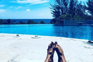 Prelepa glumica pokazala STOPALA, svi se ZGROZILI!