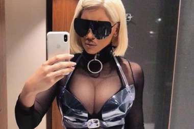 Karleuša pokazala opekotine od Sunca