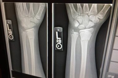 Ljudi u bedi pristajali da im bande lome kosti za 50 EVRA!