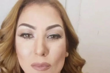 ZGRANUĆETE SE: Bivša Zadrugarka skroz izoperisala facu!