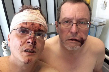 (FOTO) UZNEMIRUJUĆE! Hrvatica i njen momak BRUTALNO pretukli GEJ PAR u Belgiji!