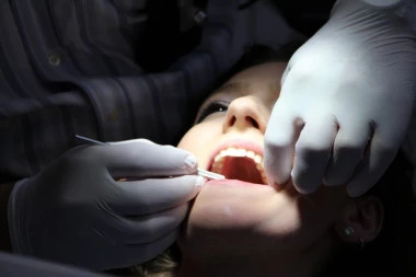Ranice u ustima češće kod žena! Evo kada je potrebno obratiti se lekaru