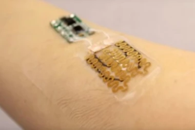 (VIDEO) ALARM, SENZOR, PROCESOR - TO JE NOVI ZAVOJ ZA RANE!