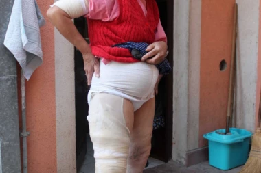 (FOTO) HOROR U ALEKSINCU: Pljačkaši satima bračnom paru PEGLOM pržili kožu, a onda je krenulo IŽIVLJAVANJE nad celom porodicom!