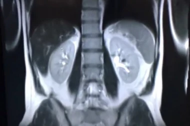 VIDEĆE VAS KROZ ZID, ALI ĆE BRINUTI I O VAŠEM ZDRAVLJU