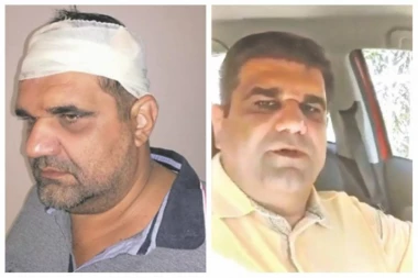 PROŠLA GA GLAVA: NEMA VIŠE ZAVOJA, A NEMA NI OGREBOTINE! Mirković skinuo čalmu i dokazao da je pravi lažov