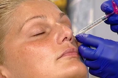 VODITELJKA PUMPALA USNE I JAGODICE U EMISIJI!