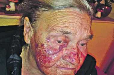 (UZNEMIRUJUĆI FOTO) STRAVIČNO RAZBOJNIŠTVO KOD APATINA: Kocem tukli baku po glavi zbog 400 EVRA!