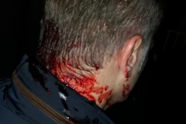 Tužilaštvo iz Kruševca: Ukinut pritvor napadačima na Borka Stefanovića