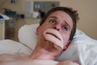 (VIDEO) Ovo je pretužno, ništa slično do sada niste videli! Ovom momku se život u trenutku preokrenuo, ostao je bez udova!