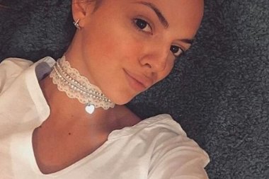 MODRICE, CRNILO I PODLIVI: Sofija Šašić nakon operacije u zavojima i flasterima, ne liči na sebe!