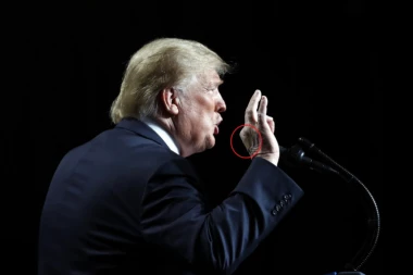 Tramp smrtno bolestan?!