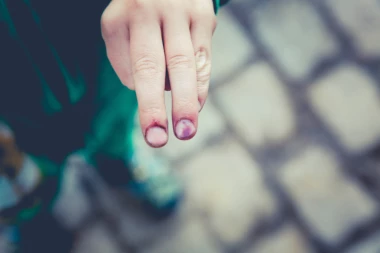 Lozničani uhapšeni zbog prebijanja: Izudarali muškarca (37) na parkingu ugostiteljskog objekta!