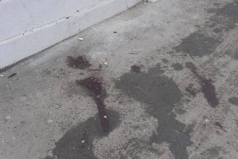 STRAVA I UŽAS U BUJANOVCU: Muž suprugu izubijao BETONSKIM IVIČNJAKOM