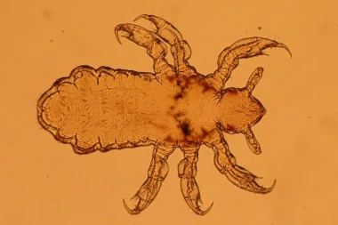 U beogradskim školama i vrtićima pojavile su se vaške!