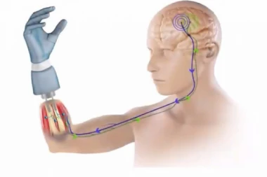 Veliki korak napred: TESTIRANA NAJPRECIZNIJA ROBOTSKA PROTEZA