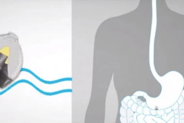 (VIDEO) REVOLUCIONARNO OTKRIĆE: "Pametna" pilula spas za milione dijabetičara