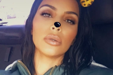 ZBOG SELFI FILTERA SVE VIŠE ŽENA IDE NA PLASTIČNU OPERACIJU: Hirurzi zabrinuti zbog njihovih zahteva!