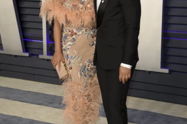 NOVI HIT među poznatim damama podelio javnost! Da li biste vi pristali na transplantaciju dlačica na licu?