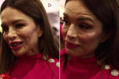 (FOTO) ŠOK! Severina potpuno zgužvana: Pevačica se pojavila u javnosti sa deformisanim licem!