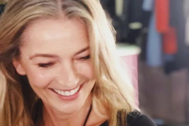 Supermodel trpi bolove gore od porođajnih da bi izgledala mlado, a da li biste vi pristali na OVO?