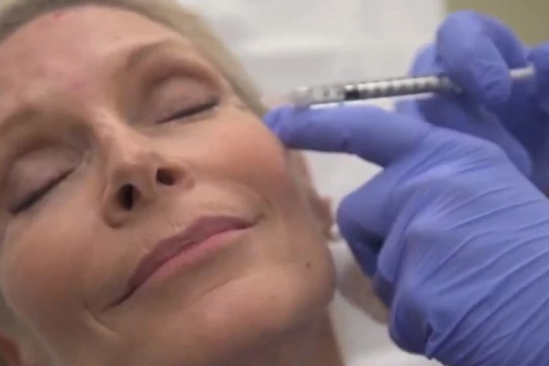 KLIJENTIMA UBRIZGAVALA BOTOKS U KOLIMA: Nove prijave protiv konobarice nadrilekarke iz Sutomora stigle u Tužilaštvo!