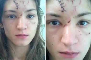 (FOTO) NEMILOSRDNO: Mladić devojku udario staklenom čašom, a onda je ona rešila da mu se osveti...