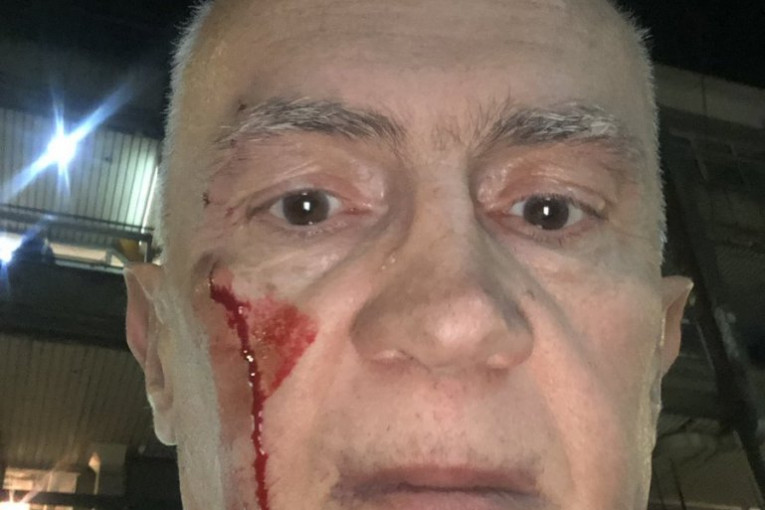 JEDVA DOČEKALI Opozicija koristi krvavu glavu Šabića za napad na Vučića