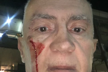 JEDVA DOČEKALI Opozicija koristi krvavu glavu Šabića za napad na Vučića