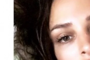 JEZIVO! Pretučena Nataša Šavija sva u PODLIVIMA, oko joj ZATVORENO nakon krvničkog prebijanja! (UZNEMIRUJUĆA FOTOGRAFIJA)