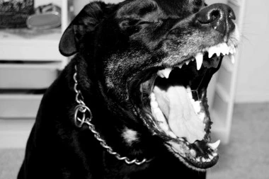 Užas! U Sremskim Karlovcima rotvajler izujedao troje dece, jednom dečaku (16) otkinuo deo mesa!