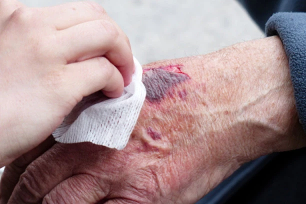 NEZAPAMĆENO ZLODELO: Nepokretnu majku polivao hladnom vodom i prebio štapom